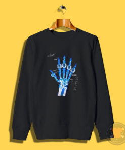 Kobe Bryant Hand X Ray Broken 5 Ring Sweatshirt